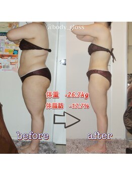 ボディグロス 梅田店(BODY GLOSS)/VIPセレブ2年ー26.7kg