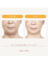 ムーンライズ(moonrise)/