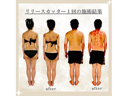 ラクアの写真