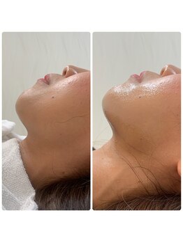 ソルニス(Solnis.)/6.5:チェック