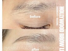 リス(Lys)/ハリウッドブロウリフト