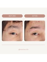 サンライズ(SUNRISE)/