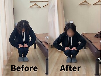 たぬきの山整骨院/育児の影響で膝がつらい
