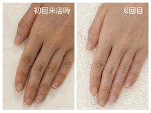 キレイテ 上野店/40代/6回目【ハンドケア上野】