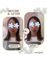 マリーゴールド(marigold)/◇結果重視ドライヘッドスパ