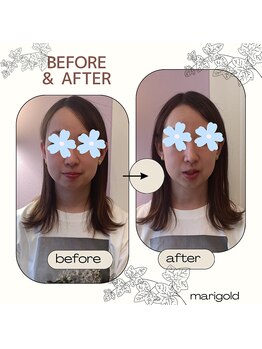 マリーゴールド(marigold)/◇結果重視ドライヘッドスパ