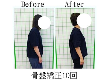のぞみ整骨院/【慢性的な肩こり】がスッキリ！
