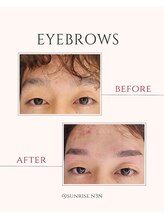 サンライズ(SUNRISE)/