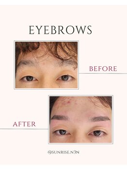 サンライズ(SUNRISE)/