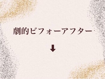 シアホワイト(CIA WHITE)/劇的ビフォーアフター