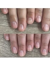 ウェルズユキ(well's yuki)/ガサガサ　甘皮が硬い　