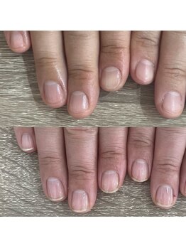 ウェルズユキ(well's yuki)/ガサガサ 甘皮が硬い