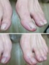 リゼラアンドコー 船橋店/ドイツ式フットケア専門店