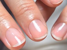 爪のコンプレックスを自分の強みに変えます