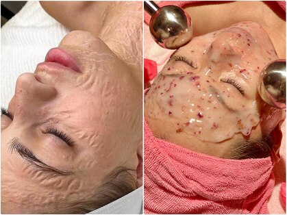 なちゅら(Nachula)の写真