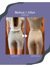 ギディアップ 中野(GIDDYUP)/