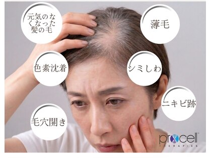 ベリー(Berry)の写真