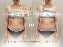 リノ(Lino)の雰囲気（各メニューの専門スタッフが担当！#ブライダルエステ#痩身）