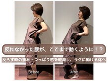 スプリング鍼灸院(Spring鍼灸院)の雰囲気（腰痛やお尻、足にまで気になるお悩みお任せください。）