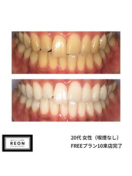 レオン 磐田(REON)/◇ お客様 before＆after ◇