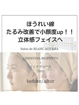 サロン ド ブラン アオヤマ(Salon de BLANC AOYAMA)/BIOPHYTO×Sonocare