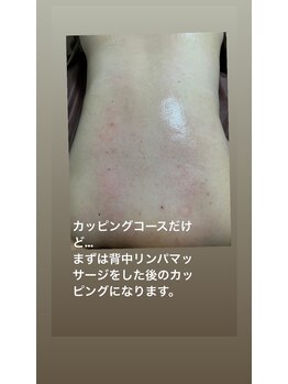 プランツ(Plants)/背中のほぐし