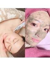 エーオーバー(A over')/エアバリ×ハーブピーリング