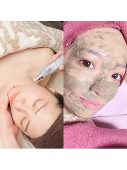 エーオーバー(A over')/エアバリ×ハーブピーリング