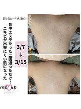 ミーアップ(Me up)/たったの2回でここまで変わる！