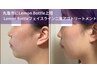 【22周年記念】丸亀市上陸！レモンボトルフェイスライン・二重アゴスッキリ