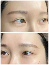 アールラッシュ(R-LASH)/