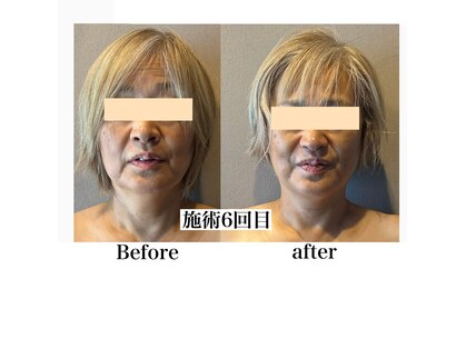 かたりべの写真