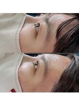 メルシー(merci)/マツパー