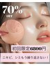【18周年★70%オフ】シミ・ニキビ脱！BB L＋ハイドロフェイシャル
