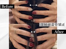 ポーベルポー(Peau Belle poe)/【自律神経整う】深層頭蓋骨矯正