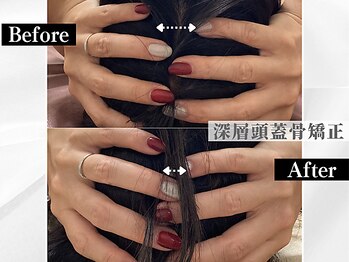 ポーベルポー(Peau Belle poe)/【自律神経整う】深層頭蓋骨矯正