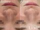 ライム 錦糸町(LIME)の写真