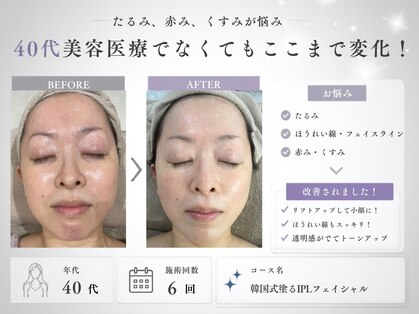 ミヨンラボ(miyon LABO)の写真