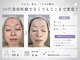 ミヨンラボ(miyon LABO)の写真