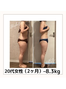 カトレア 下関店(KATOREA)/20代モニターさま