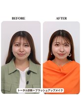 シュアリー(Surely)/ペアトータルコースお客様事例