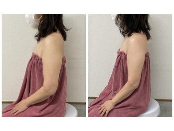 ブリランテ(Brillante)/