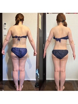 ビーエスアクアビューティー/部分＋全身リンパ