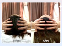 ハノハノ 八代店(HANO HANO)/NR小顔リフトアップ☆