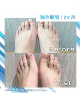 メンズクリア スマーク伊勢崎店/【メンズクリア】お客様の施術例