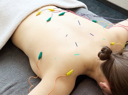 ソエルテの写真