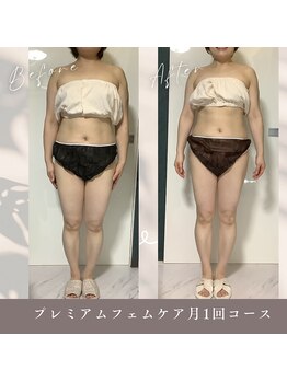 パラアモール(Paraamor)/フェムケアのボディの変化