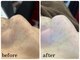 ジョルフ サロン オリジナル(JOLF salon original)の写真/【毛穴の黒ずみ・角栓除去】EIENの過熱水蒸気で汚れを浮かせ、超音波＆吸引でごっそり毛穴レス肌へ！