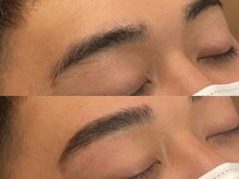 ビクシー(vixxcy)/メンズビフォーアフター