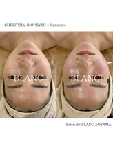 サロン ド ブラン アオヤマ(Salon de BLANC AOYAMA)/BIOPHYTO×Sonocare